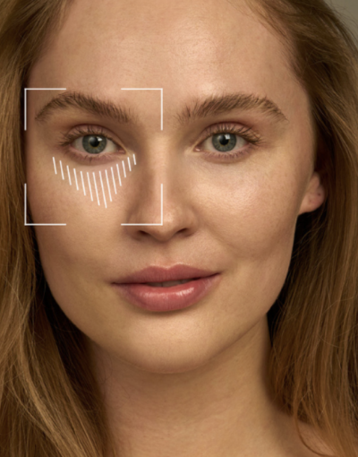 AI skincare